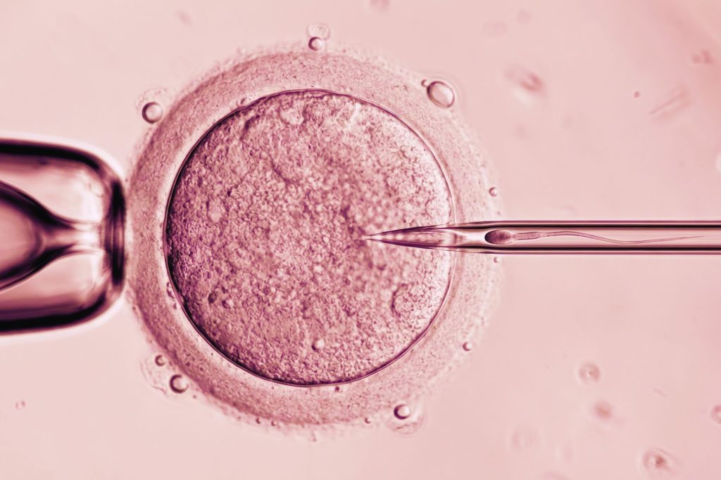 Diagnosi genetica pre-impianto: cosa sapere &ndash; Centro Demetra